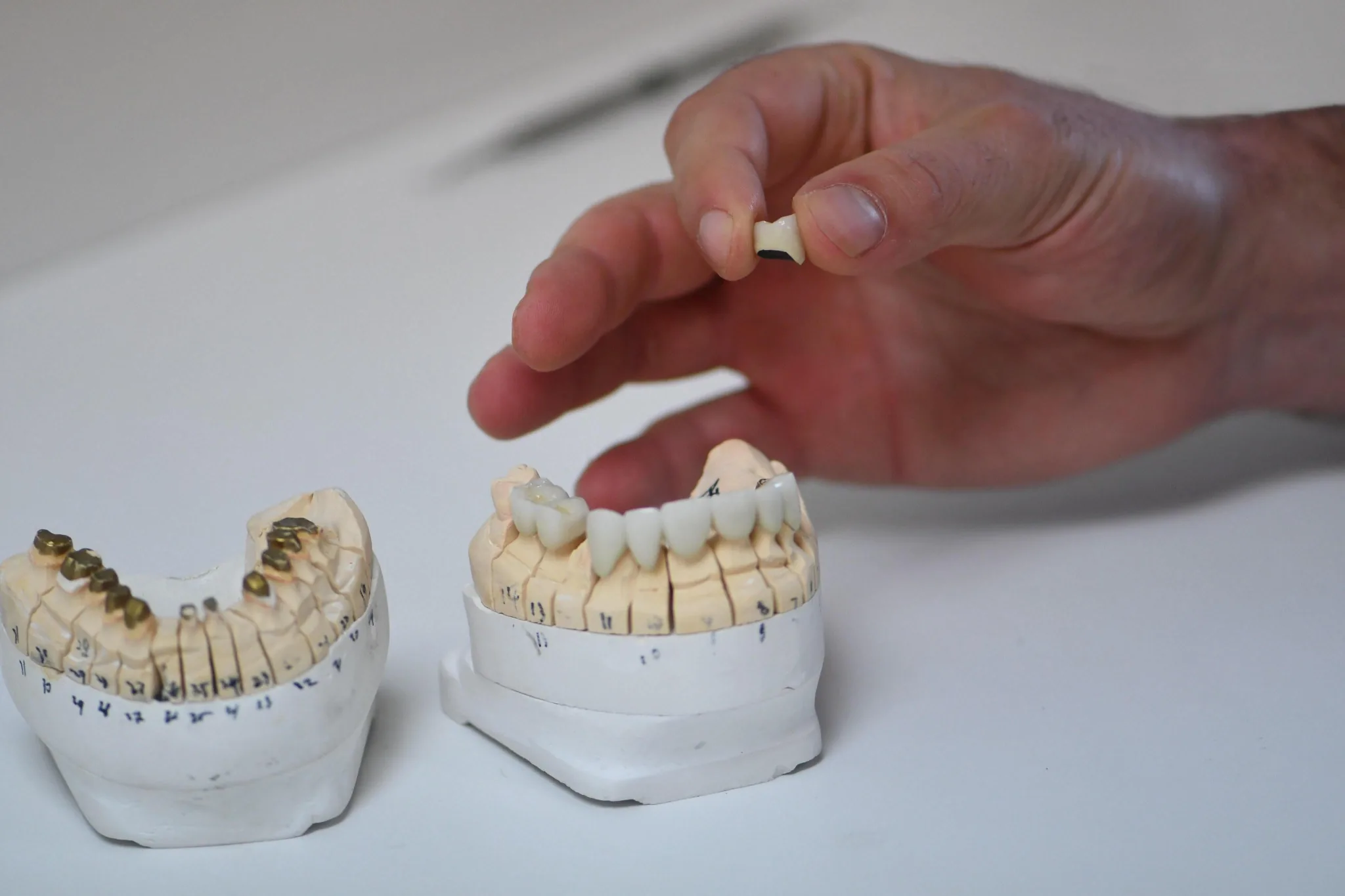 Zirconia Crowns